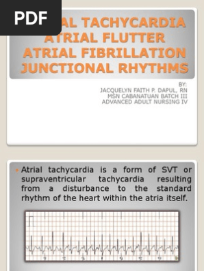 Atrial Tachycardiia Atrium Heart Heart