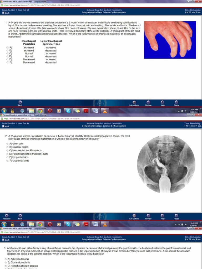 Nbme Cbssa Form 13 No Answers | PDF | Herpes Simplex | Physical Examination