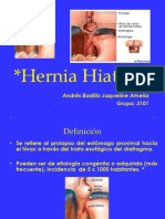 Hernia Hiatal Expo