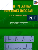 EKG