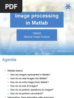 Image Processing in Matlab: TBMI02 Medical Image Analysis