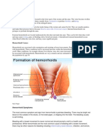 Hemorrhoid Overview