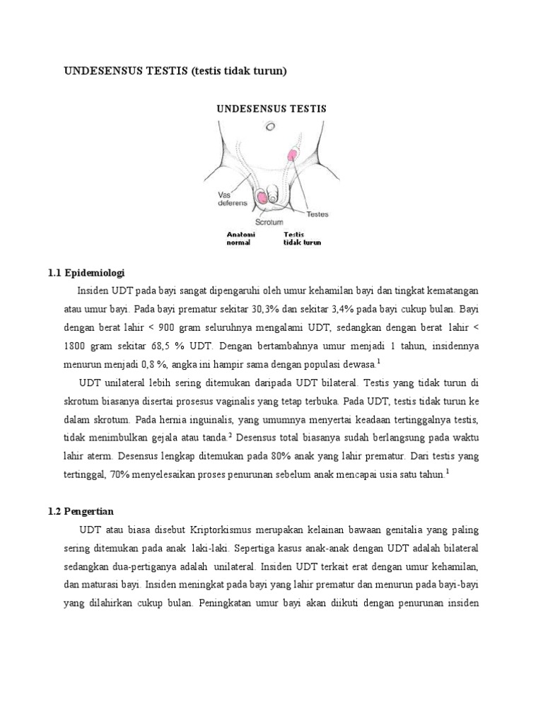 Bilateral Undesensus Testis