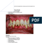 Enfermedades Dentales1