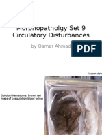 Morphopatholgy Set 9 Circulatory Disturbances: by Qamar Ahmad