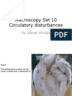 Macroscopy Set 10 Circulatory Disturbances: by Qamar Ahmad