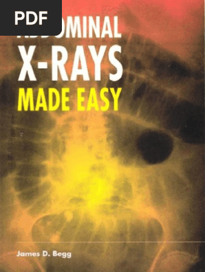 Abdominal X Ray Made Easy Pdf
