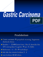 Referat Bedah Gastric Carcinoma
