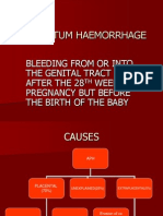 Antepartum Haemorrhage by DR Dhananjay B S PROF OF OBG SSMC TUMKUR