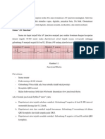 Irama Junctional Fix