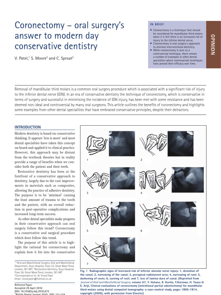 Coronectomy - Oral Surgery's Answer To Modern Day Conservative ...