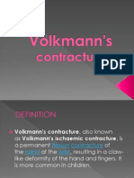 Volkmann's Contracture