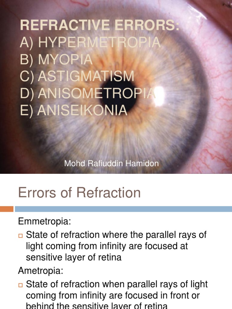 Errors of Refraction Human Eye Eye