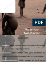 Marasmus Kwashiorkor