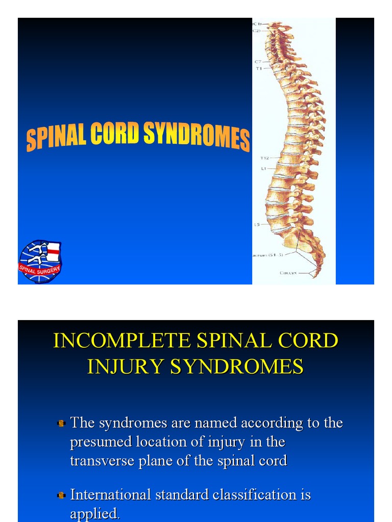 Spinal Cord Syndromes Spinal Cord Neuroanatomy