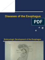 Esophagus Surgery
