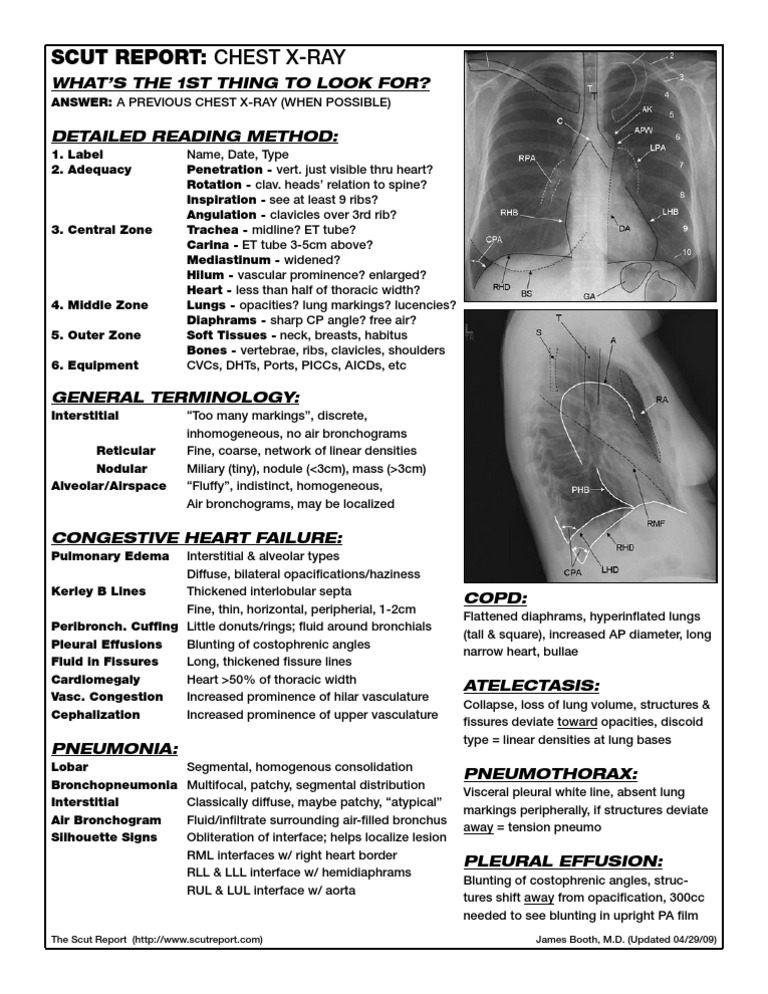 Scut Report Chest XRay Lung Thorax
