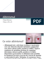 Albinism Ul