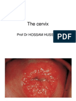 The Cervix: Prof DR Hossam Hussein