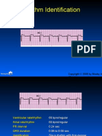 Practice ECGStrips