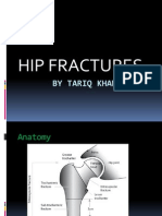 Hip Fractures: by Tariq Khan