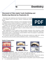 Fiber Splint1(c)