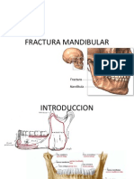 FX Mandibular