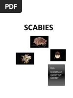 Skabies