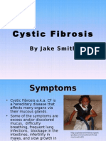 Cystic Fibrosis: by Jake Smith