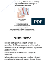 Self Expandable Esophageal Metalic Stents (SEEMS) Ppt