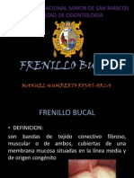 FRENILLO BUCAL