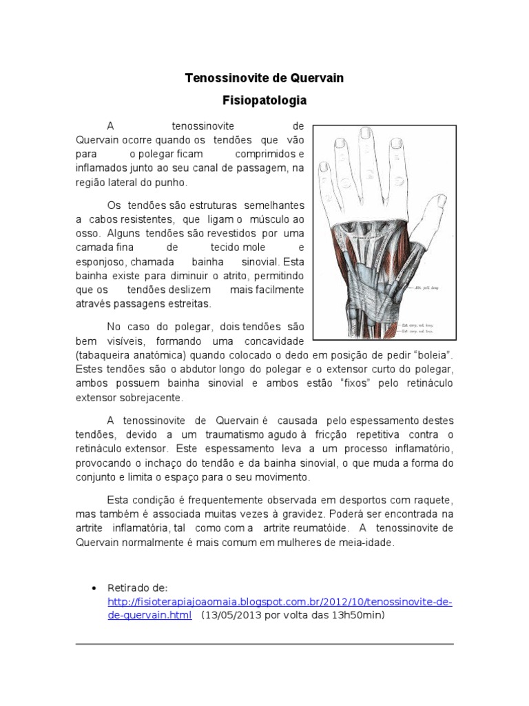 Fisiopatologia - Tenossinovite de Quervain | PDF | Tendão | Inflamação