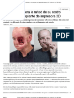 Hombre Recupera La Mitad de Su Rostro Gracias A Un Implante de Impresora 3D - Tendencias - LA TERCERA