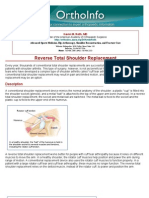 reverse total shoulder replacement-orthoinfo - aaos