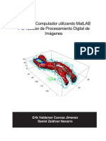 Procesamiento Digital de Imágenes en Matlab