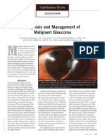 Diagnosis and Management of Malignant Glaucoma