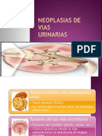 Neoplasiasurinarias Cx
