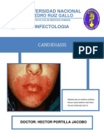 Seminrio de Infectologia - Candidiasis