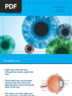 Primary Glaucoma