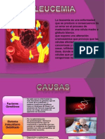 Leucemia Diapositivas