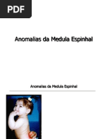 Anomalias Da Medula Espinhal