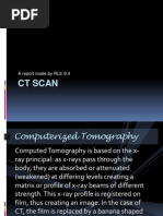Download CT SCAN AND MRI by kristine_silang SN150823050 doc pdf