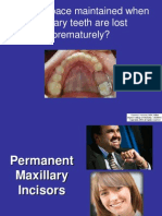 12 MX Permanent Incisors 2011