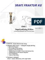 Download Radiografi Fraktur Kedokteran Gigi by Fatimah Az-Zahrah SN150849472 doc pdf