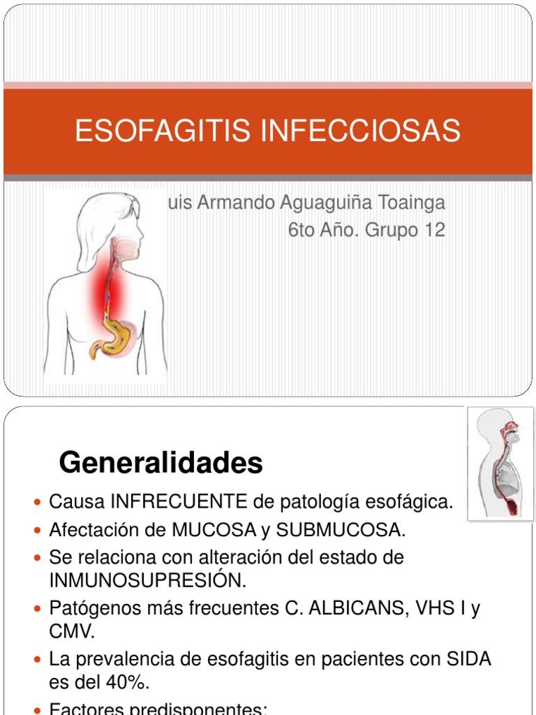 Tratamiento de la esofagitis infecciosa | PDF | Candidiasis ...