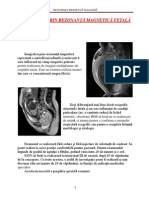 RMN Fetal