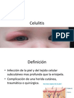 Celulitis, causas, síntomas y tratamiento