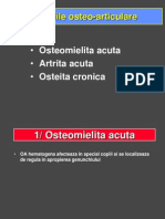 Osteomielita