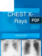 Chest x Rays 