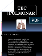 Caso Clinico de Tuberculosis Pulmonar